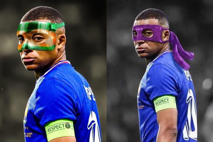 Cập nhật quan trọng về chấn thương của Kylian Mbappé: Đội trưởng Pháp chuẩn bị phẫu thuật mũi gãy