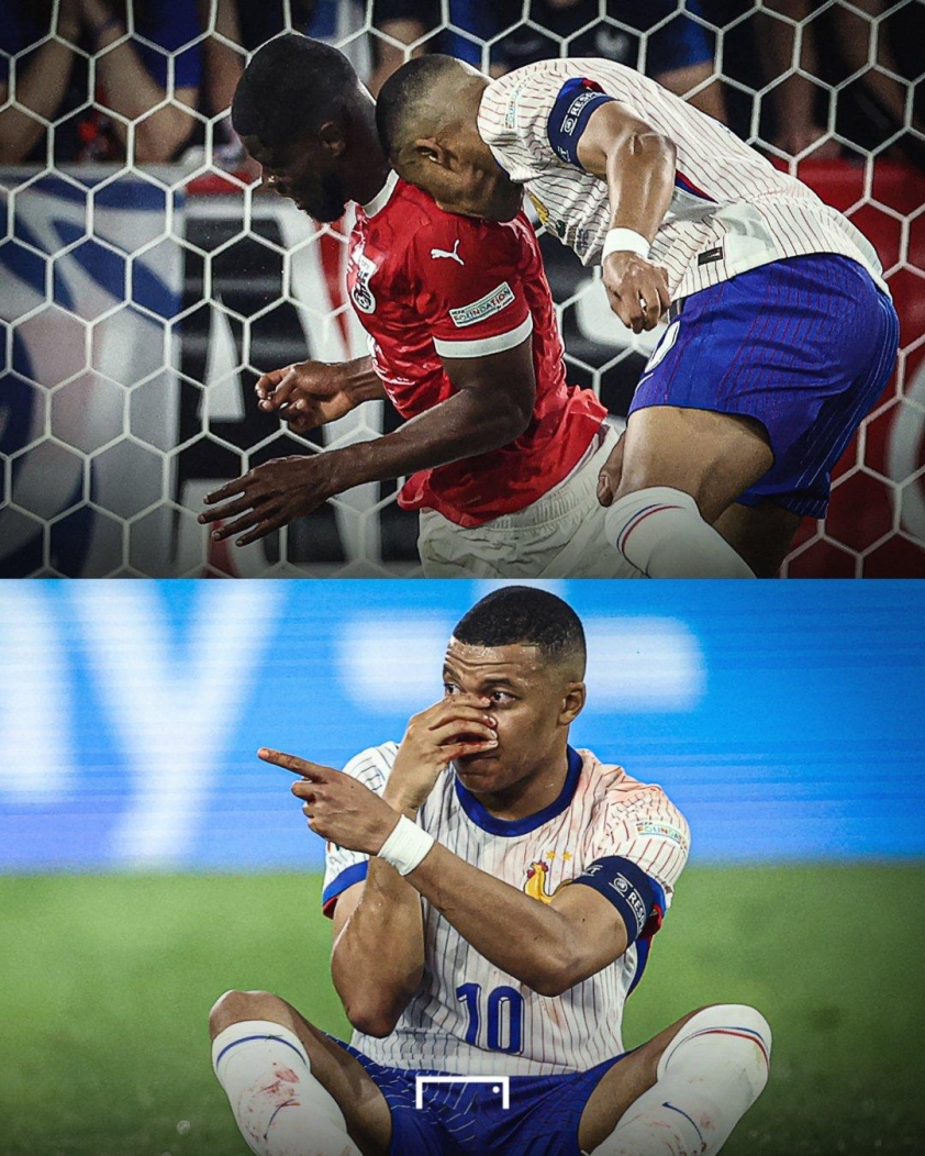 Cập nhật quan trọng về chấn thương của Kylian Mbappé: Đội trưởng Pháp chuẩn bị phẫu thuật mũi gãy