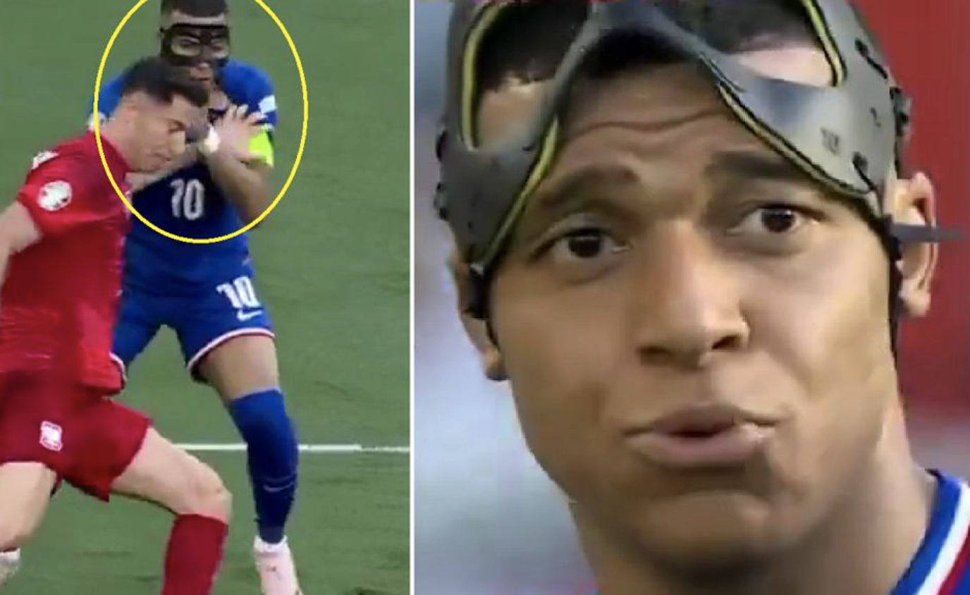 Vấn đề lớn nhất của Mbappe và Pháp không phải ở chiếc mặt nạ