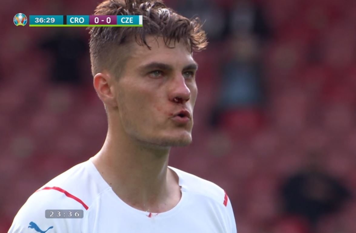 Ảnh chế Croatia vs CH Séc
