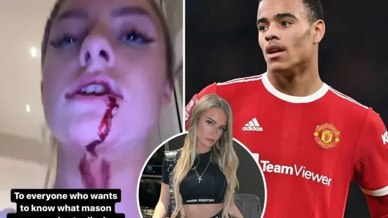 Mason Greenwood bạo hành bạn gái