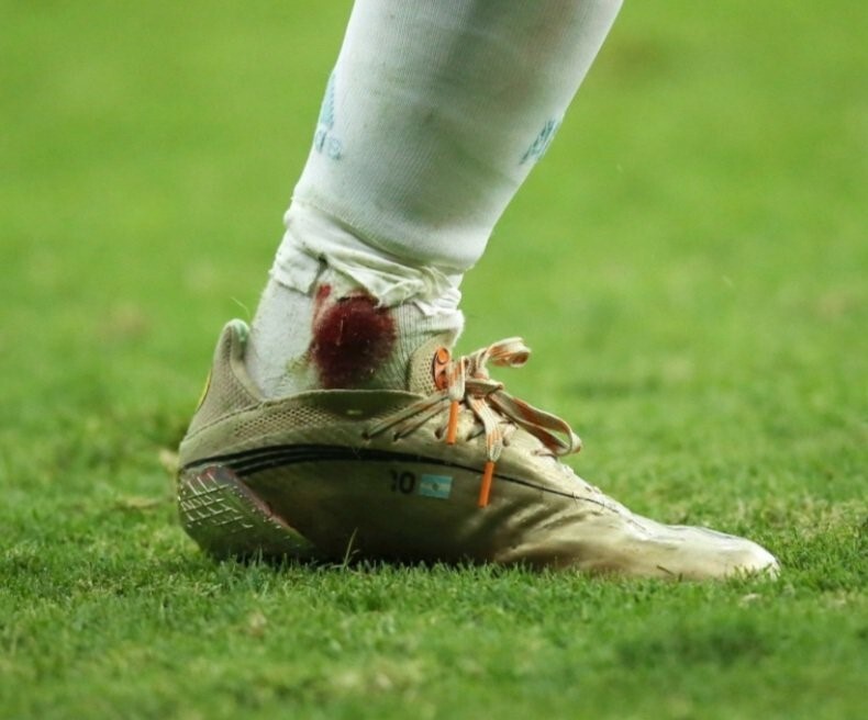 Chân trái rỉ máu của Messi