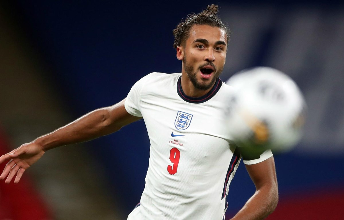 Dominic Calvert Lewin (Anh - 24 tuổi) Dominic Calvert Lewin (Anh - 24 tuổi)