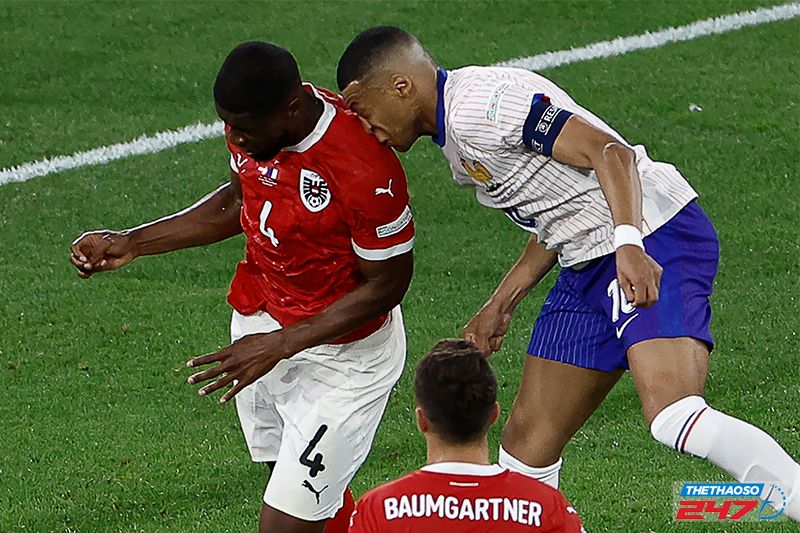 Chấn thương mũi của Mbappe là khá phức tạp