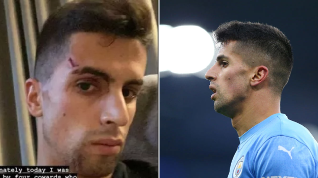 Cancelo bị trộm đột nhập vào nhà hành hung 