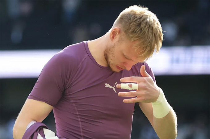 Aaron Ramsdale: Vận đen đeo bám hay năng lực thực sự?