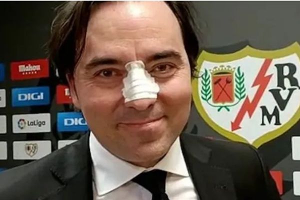 Chủ tịch Rayo Vallecano bị húc gãy mũi khi đàm phán ký kết hợp đồng
