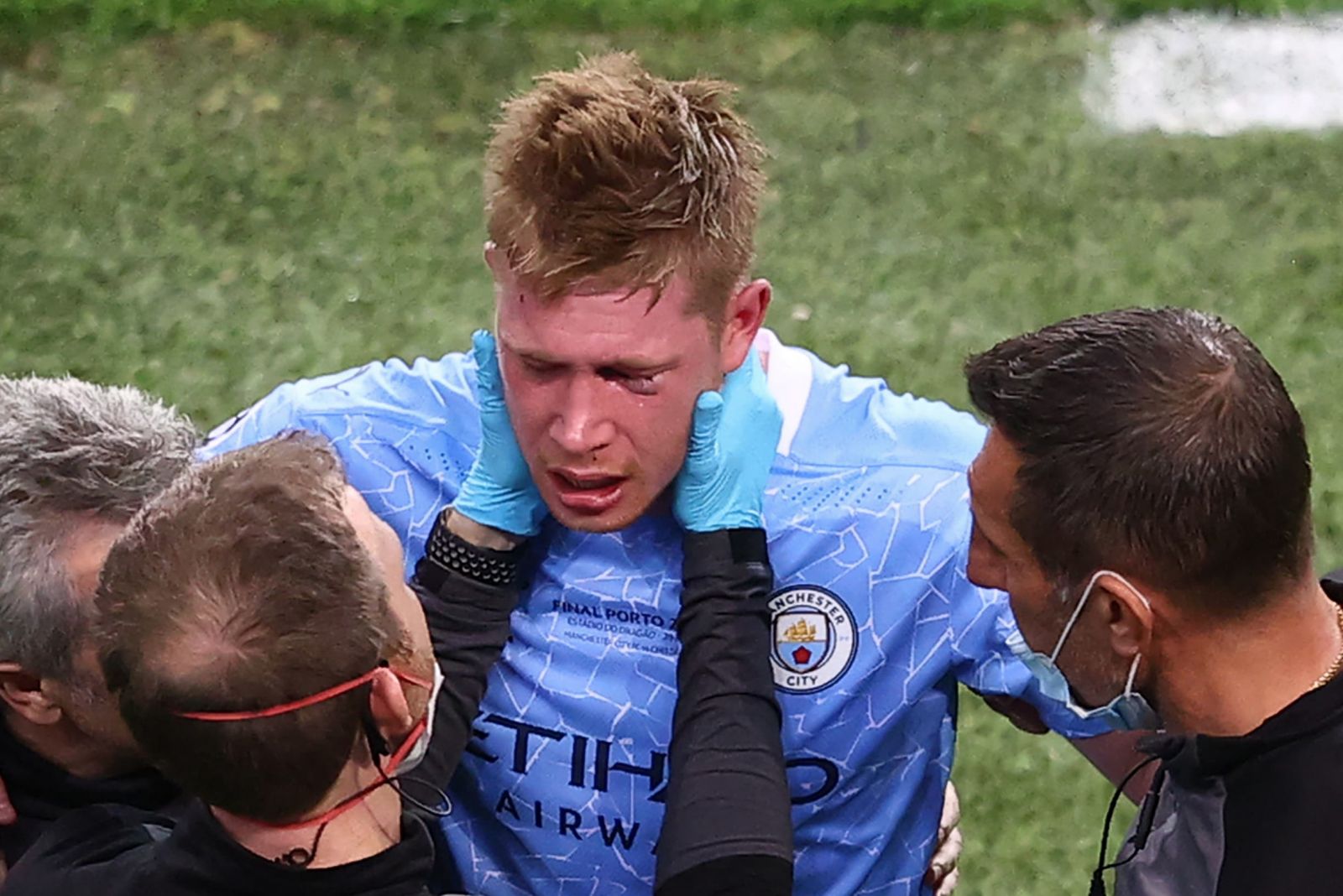 Kevin de Bruyne chấn thương Kevin de Bruyne chấn thương