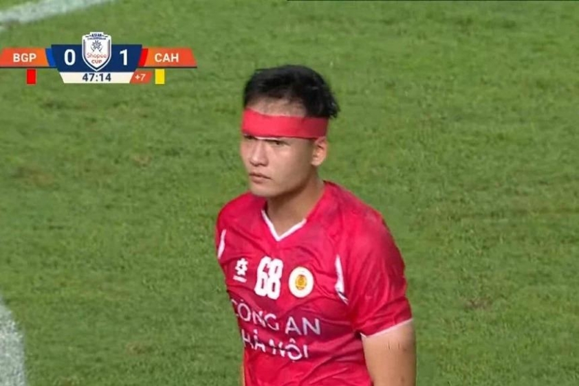 Bùi Hoàng Việt Anh bị thương vùng đầu