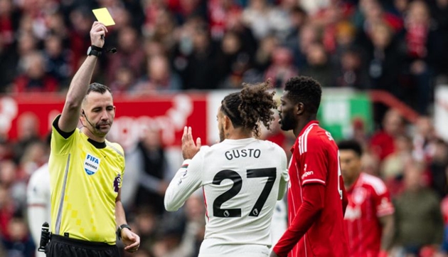 Malo Gusto dính thẻ đỏ trong trận gặp Nottingham Forest