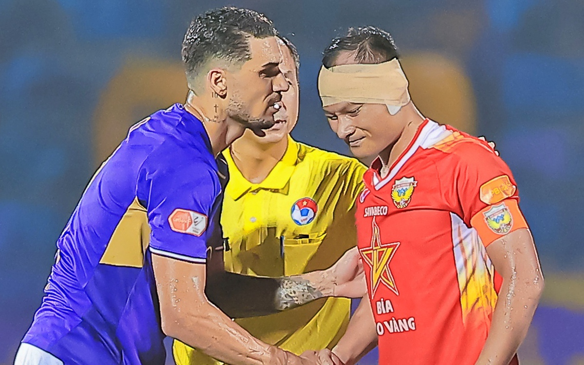 Trọng Hoàng suýt đứt tai sau pha va chạm kinh hoàng ở V-League trong